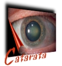 Catarata